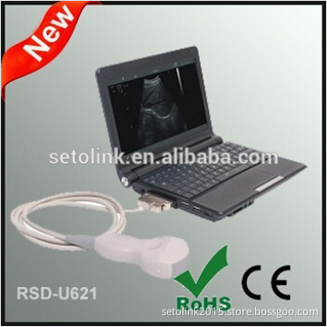 New Launched Laptop Ultrasonic Diagnostic System Scanner